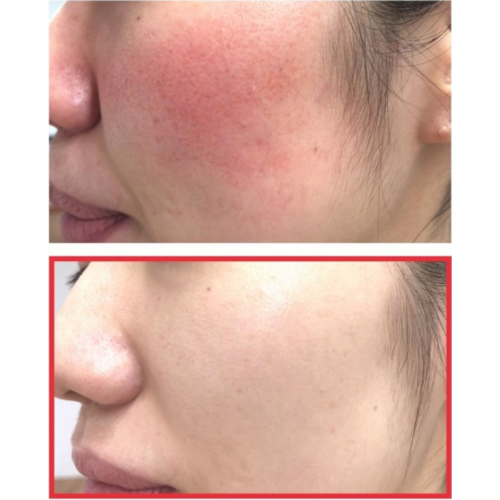 Some by mi Snail Truecica Miracle Repair Cream