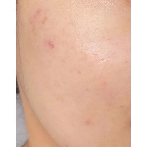 Real Barrier Aqua Soothing Peeling Gel