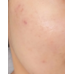 Real Barrier Aqua Soothing Peeling Gel