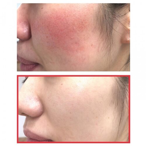 Some by Mi Snail Truecica Miracle Repair Starter Kit