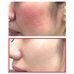 Some by Mi Snail Truecica Miracle Repair Starter Kit