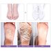 Mj Care Soft Miracle Foot Peeling Pack