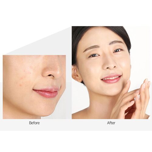 Medi-Peel Herbal peel tox