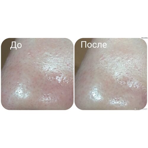 Ciracle Pore Control Tightening Serum