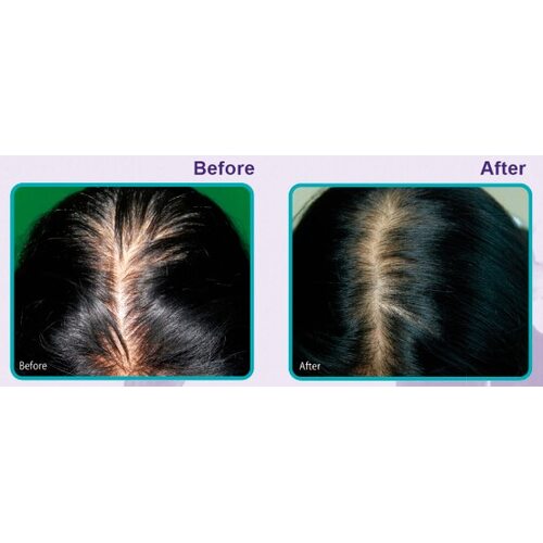 Daeng Gi Meo Ri Vitalizing Scalp Nutrition Pack For Hair Loss