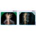 Daeng Gi Meo Ri Vitalizing Scalp Nutrition Pack For Hair Loss