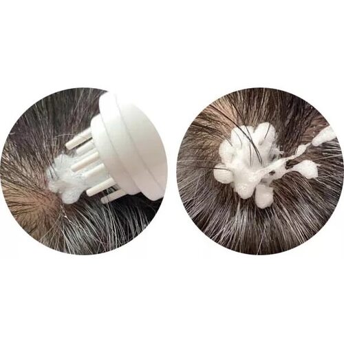 Masil Sparkling Scalp Bubble Tick