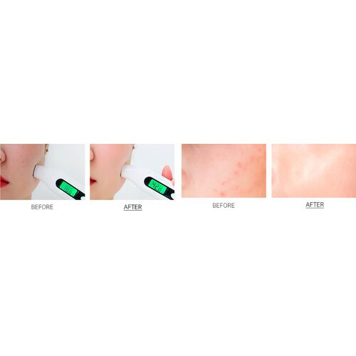Medi-Peel Cencica Calming Ampoule