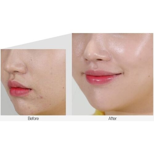 Medi-Peel Cencica Calming Ampoule
