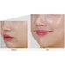 Medi-Peel Cencica Calming Ampoule