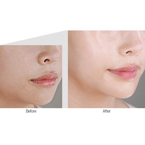 Medi-Peel Cell Toxing Dermajours Ampoule