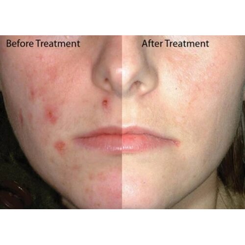 Some by mi Red Teatree Cicassoside Toner