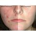 Some by mi Red Teatree Cicassoside Toner