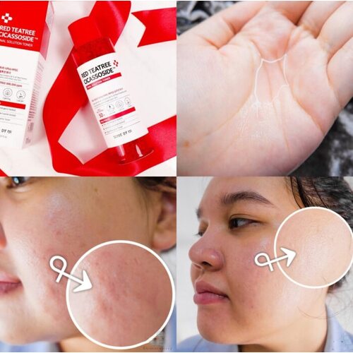 Some by mi Red Teatree Cicassoside Toner