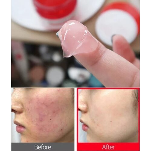 Some by mi Red Teatree Cicassoside Cream