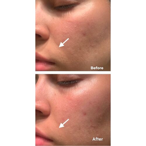 Ample N PeptideShot Ampoule