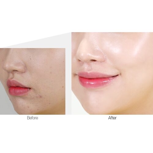 Medi-Peel Cencica Alla Cream