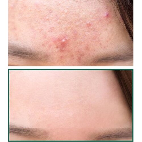 Some By Mi AHA.BHA.PHA 30 Days Miracle Cleansing Bar