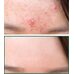 Some By Mi AHA.BHA.PHA 30 Days Miracle Cleansing Bar