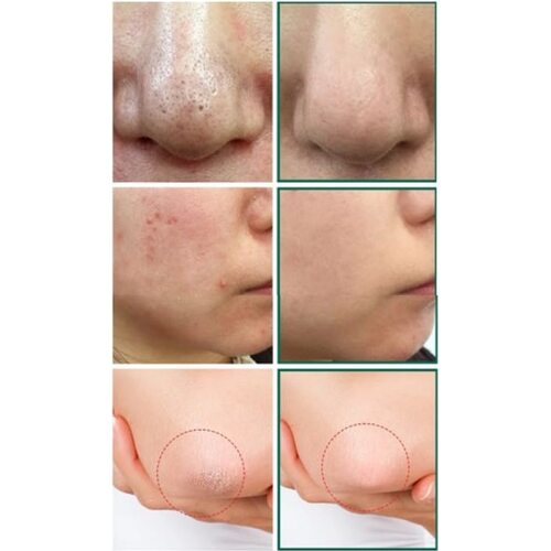 Some By Mi AHA.BHA.PHA 30 Days Miracle Cleansing Bar