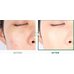 VT Cosmetics Cica Redness Spot Concealer